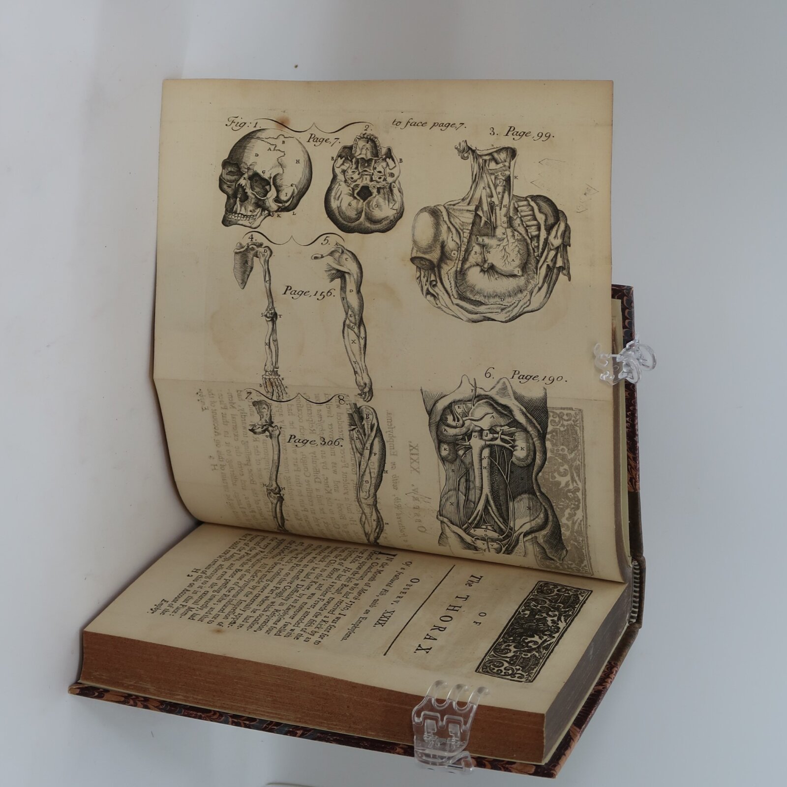 Observations in Surgery. 1739 - Image 5