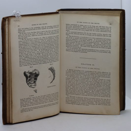 Churchill's System of Midwifery. Condie. - Image 4