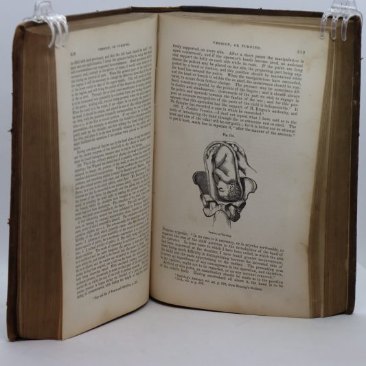 Churchill's System of Midwifery. Condie. - Image 5